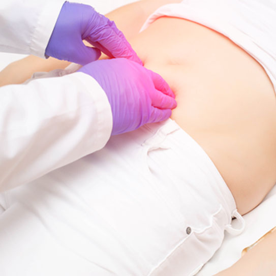 Hernia